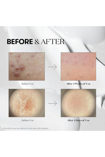 Reedle Shot 100 – 50ML